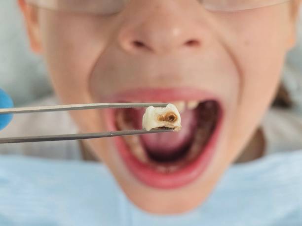 Best Emergency Treatment for Oral Infections in Shelby, NC